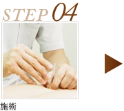 STEP4 施術